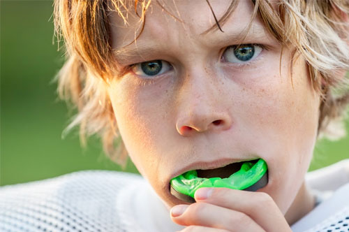 Custom Mouthguards Should Be on Your Back-to-School List